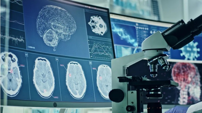 El cerebro de las mujeres: 1 de cada 6 tiene riesgo de ACV a partir de los 60 años