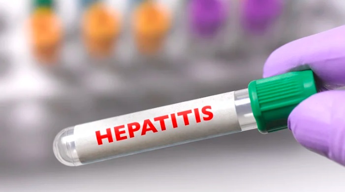 Crecen los casos de hepatitis grave de origen desconocido: los expertos buscan la causa de la enfermedad